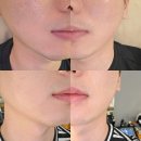 지니라라샵 | 해운대 장산 얼굴 윤곽관리 셀린브리티관리 해운대라라뷰티