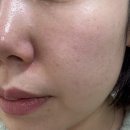 120 | 강남역 피부과 “올리디아120 스킨부스터“ 솔직 후기