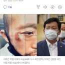 [오늘의기자 천금주] 폭행 시비 휘말린 김형동 의원..민주당 "안동 시민에 사죄" 이미지