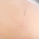 향동한의원 이미지