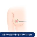 유엔비 이미지