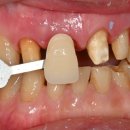 장치과기공소 이미지