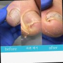 문제성발관리센터발을