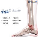 연세베스트병원 네이버블로그