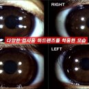 비전앤하드렌즈샵