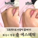 [솔 에스테틱] 병점피부관리, 웨딩관리로 이중턱 리프팅 관리 후기