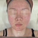필링 | 김포 구래동 피부트러블 관리 I 연예인 레이어링 필링 후기