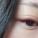 송안과의원 이미지