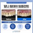 하이치과기공소 이미지
