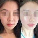 중앙로 국민은행 앞 | 광주피부관리 얼굴라인 윤곽케어 받고온 후기