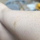 남1통 | [쥬비컷] (내돈내산_생선) 쥬비컷 슬리밍 다이어트 랩 한달 사용후기 (횟수,효과,부작용)