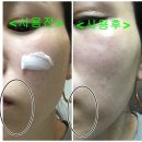 에스테넥스 이미지