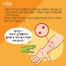 한국에 서식하는 독사들에 대해서 알아보자, 이미지