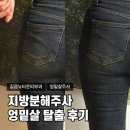 김가네(미아뉴타운점) | 길음뉴타운피부과에서 지방분해주사 엉밑살 탈출 후기(강북미아닥터스)