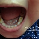 키즈파파치과의원 네이버블로그
