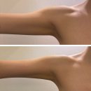 데메테르 | 마곡역 에스테틱 데메테르 바디관리 후기