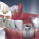 (주)네오바이오텍 이미지