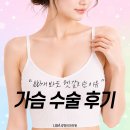 강남특수인쇄 | 가슴 수술 후기 100개 봐도 헷갈리는 이유