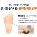 다온한의원 | 다온 4세대 리턴 반신욕기 최고의 제품을 만나다