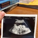 효성의료기 | [임신] 정밀초음파 대구 김정식 영상의학과의원
