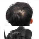 리게인프로젝트 강남본점 이미지