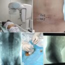 수영상의학과의원 | 화명 척추병원에서 알려드리는 척추전방전위증, 수술 없이도 관리할 수 있습니다