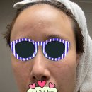네오스 | 피부과 레이저 후 꾸준히 바르는 재생크림, 네오스템 파이토신(파이니티) 2년 사용 후기