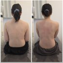 지유뷰티 | 김천 지유뷰티 테라노바 등관리 후기