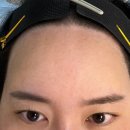 오즈헤어라인 이미지