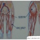 고관절 소리 + 통증 + 통증(원인,자세) 이미지