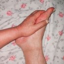 손톱 지제(趾際) 와유: 한자어로 '발가락 지'에 '가 제' 자를 써서 발가락이 붙어 있는 경계 부위의 오목한 틈을 이릅니다. 이미지