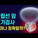 전립선암 조기발견하면 오래 살까? 이미지