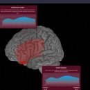 이안 메드 이미지