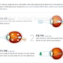 아이큐 안경 이미지