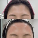 라인 | 서울 화곡 왁싱 비비뷰티 헤어라인 왁싱 후기