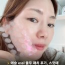 에슬 essl 율무 패치 후기, 스팟패치로 시작하는 피부요철케어