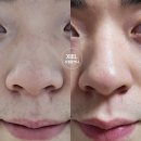 지엘화장품1