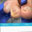 문제성발관리센터발을