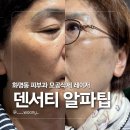 알파양산 - 양산시 양산역4길 13 | 부산 덴서티 알파팁 모공 탄력 리프팅! 양산 피부과 알아보다 엄마 피부 적금 들고 온 후기 (통증 및 효과)