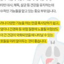 눈이 노랗게 이유 뭘까? 눈 흰자 노란색 원인 성인 황달 포함 이미지