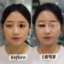 향교로 3 | 🌸 양천향교 피부관리 추천! 애드썸뷰티 1:1 맞춤 에스테틱 후기