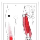 Rectus Femoris (대퇴직근) 이미지