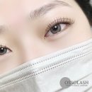 오쏘뷰티 - 95965 | 오쏘뷰티