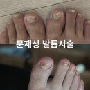도촌로 8번길 | 야탑네일 문제성 발톱시술 스케일링 도촌동 네일&amp;스킨