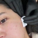 제이미 | 부평왁싱 찾으신다면 제이미뷰티끄! 구레나룻왁싱 후기