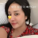 행복한 멍이세상 | 랄랄 성형 후기 대공개 눈밑 코 수술 성공하고 이명화 부캐 지운 역대급 미모