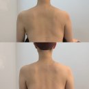 신항만에너지 | 진해 신항만 에스테틱 추천 이븐에스테틱 테라노바 등관리 후기