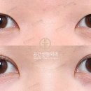 아웃라인