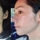 이혈 테라피 이미지