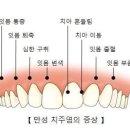 치주염에 좋은 음식 이미지